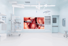 Különleges monitort dob piacra az LG